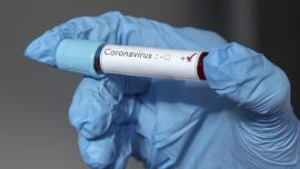 Karşıyaka'da 4 yeni koronavirüs vakası